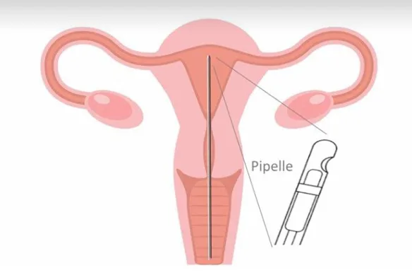 Τι είναι το ENDOTEST;