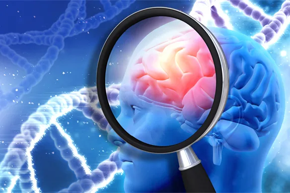 MIND diet και Alzheimer