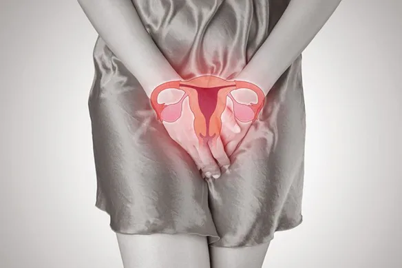 Αδενομύωση