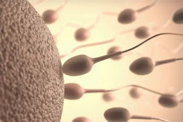 Τι είναι η εξέταση FISH