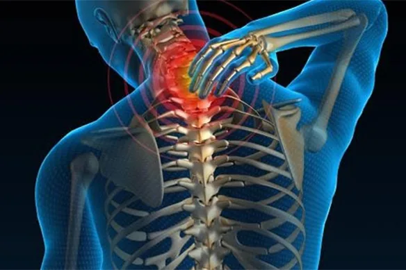 Αυχενική συνδρομή