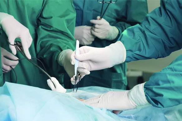 Ποια μέθοδος επέμβασης αιμορροΐδων είναι η καλύτερη;