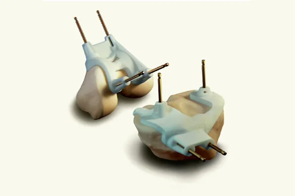 Ολική αρθροπλαστική με εργαλεία PSI